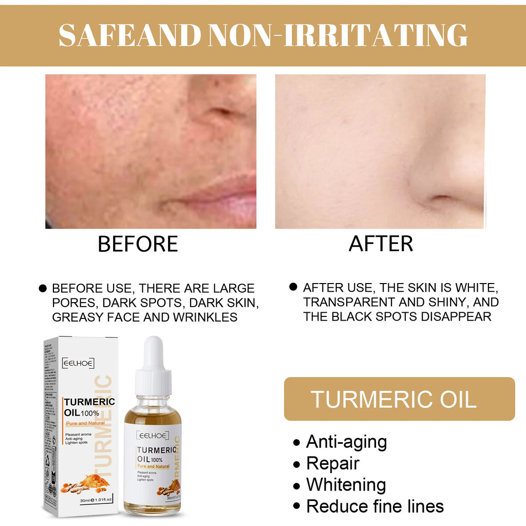 Eelhoe Turmeric Face Serum – Brightening & Dark Spot Essence Brightening Face Serum QXL