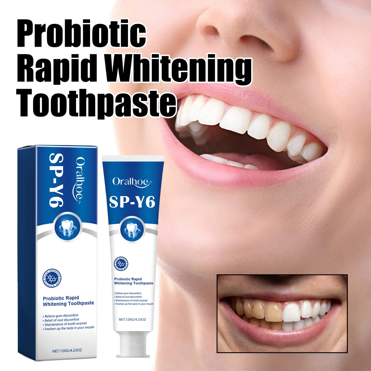 Eelhoe Xylitol Probiotic Whitening Toothpaste 120g Whitening Toothpaste QXL