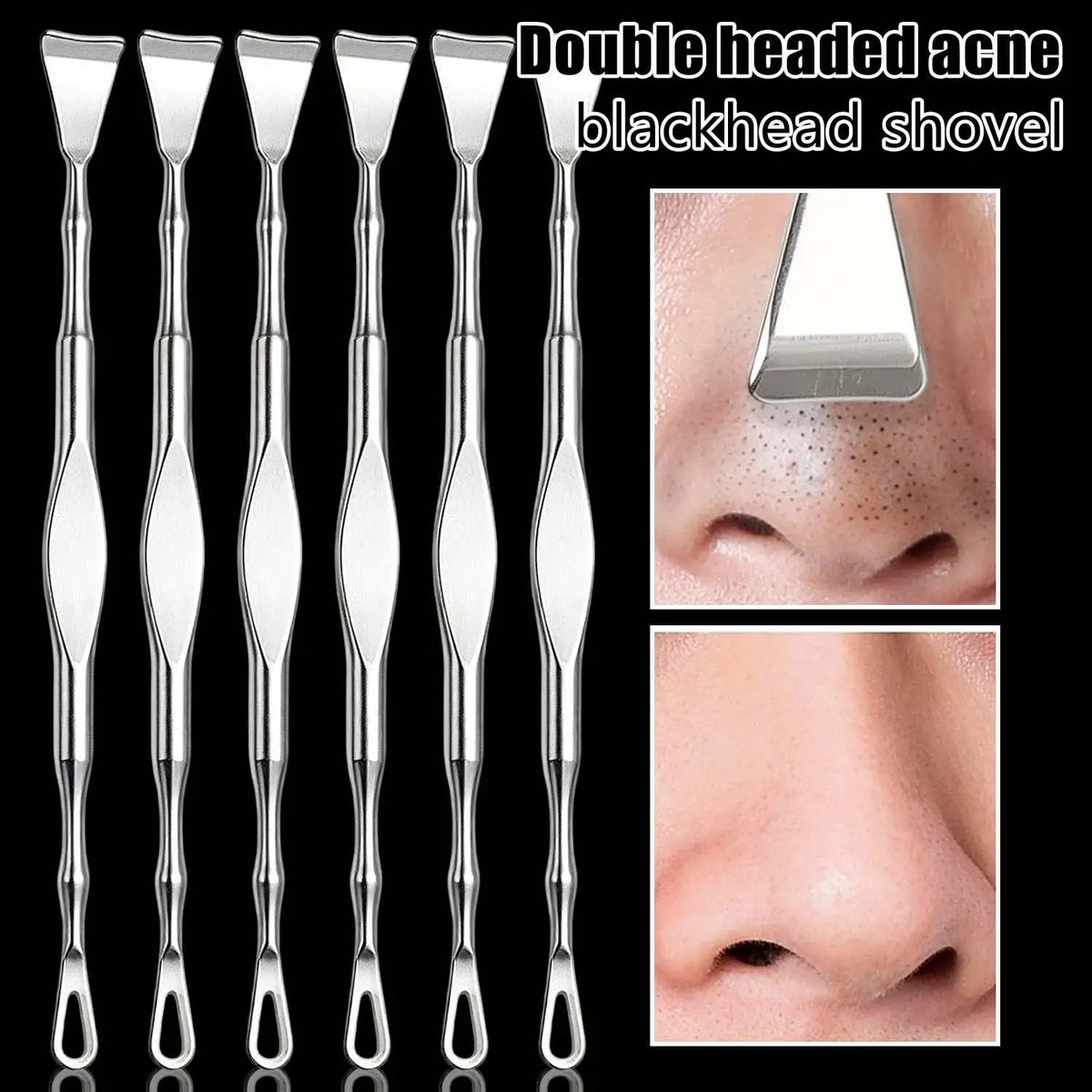 Double-Ended Stainless Steel Blackhead Extractor Tool Blackhead Extractor Tool QXL