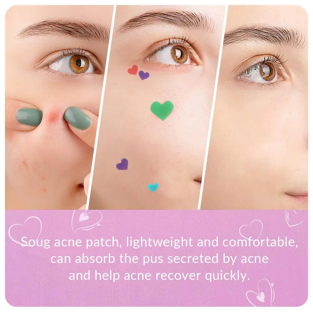 144-Pc Heart Blemish Spot Patches | 0.1mm Thin Skin Cover Blemish Spot Patch QXL