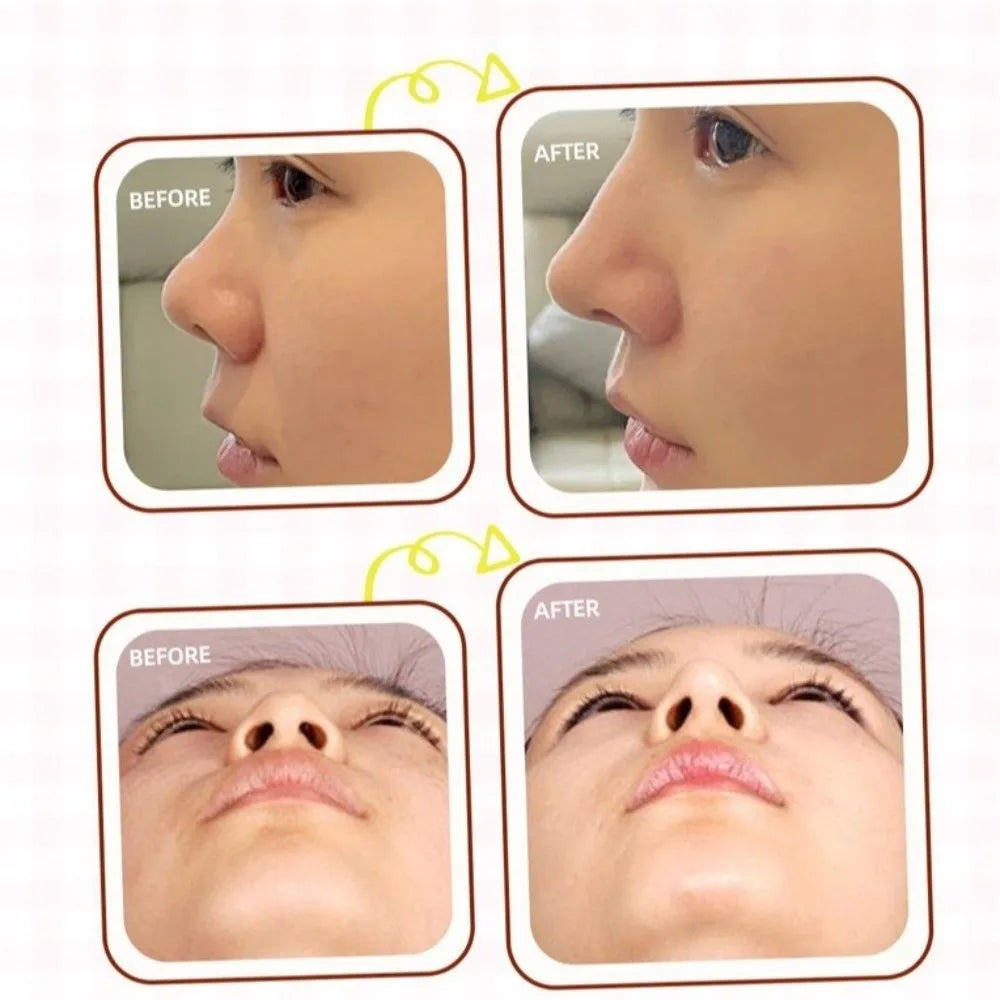 Reusable Nose Shaping Stickers | Cuttable Lift Strips 10–50 Pcs Nose Shaping Stickers QXL