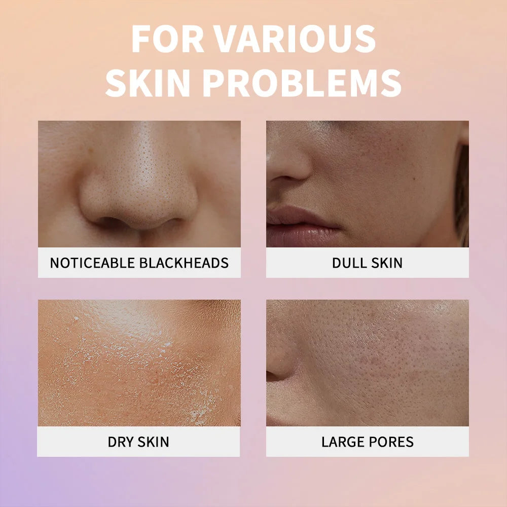 Rice Exfoliating Serum – Brightening & Hydrating Ampoule Exfoliating Serum QXL