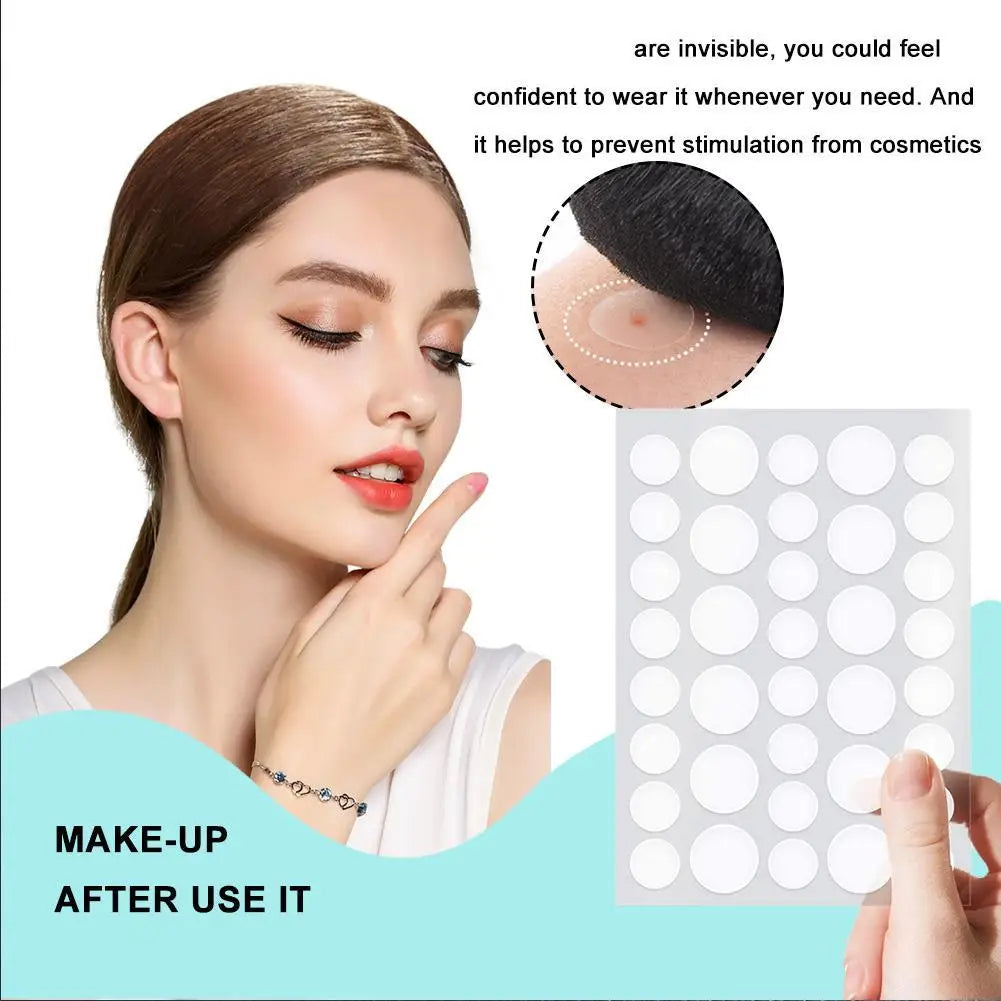 Hydrocolloid Pimple Patches with Tea Tree Oil | 72 or 288 Pack Acne Pimple Patches QXL