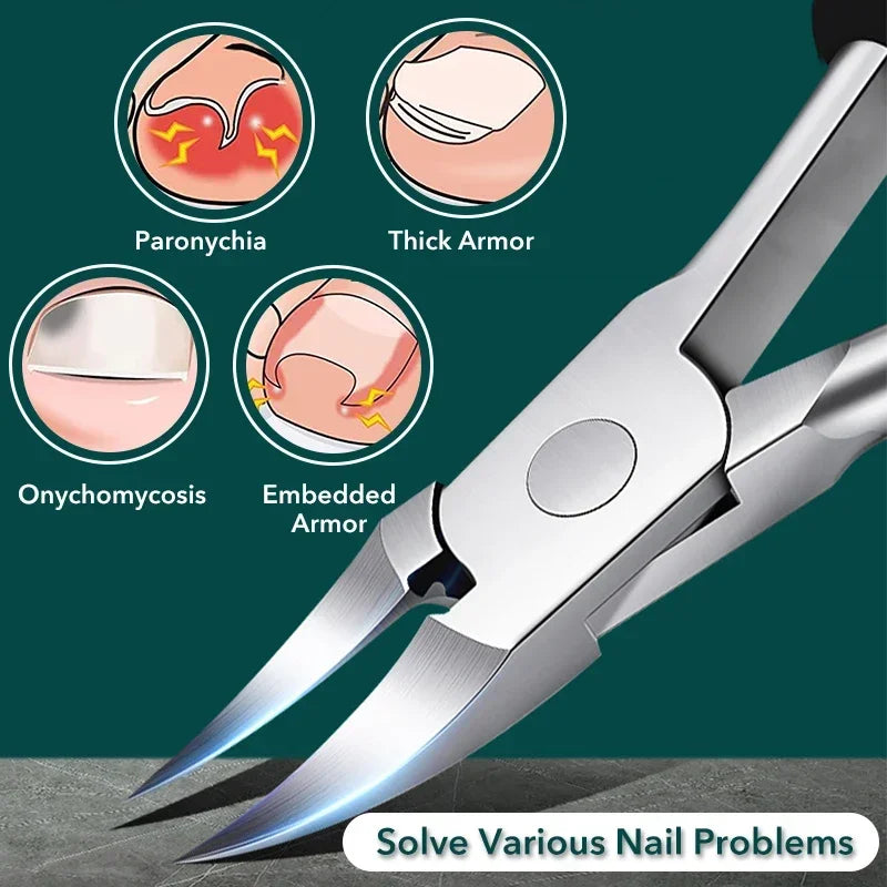 Ingrown Toenail Clipper & Cuticle Nipper | Stainless Steel Toenail Clipper Nipper QXL