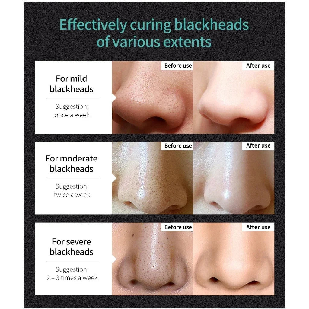 LANBENA Blackhead Remover Mud Peel-Off Face Mask 50g Peel-Off Face Mask QXL