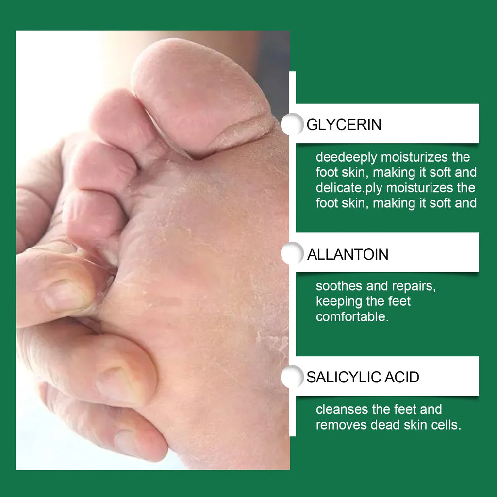 Eelhoe Orange Oil Foot Peeling Spray | Callus & Dead Skin Foot Exfoliating Spray QXL