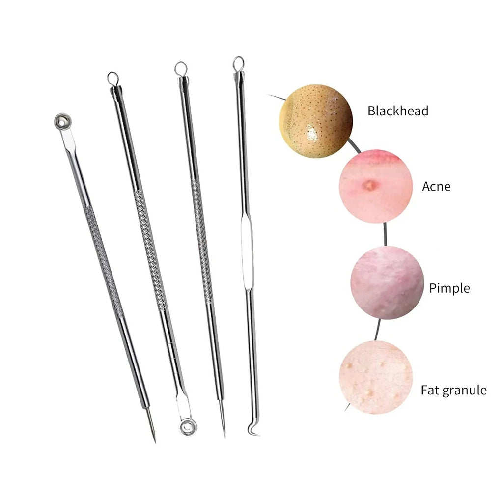 4-Piece Blackhead Extractor Tool Set | Stainless Steel Skin Care Blackhead Extractor Set QXL