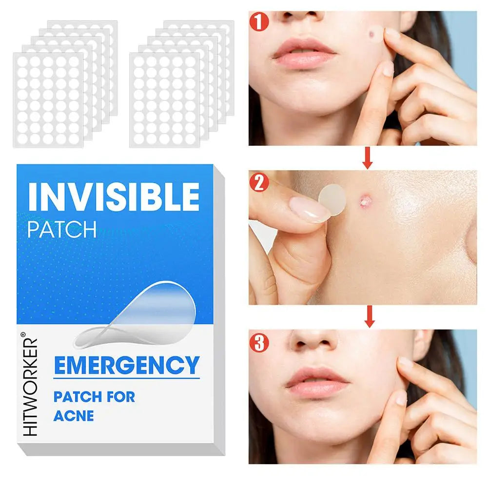 Hydrocolloid Acne Patches 400–1200 Pcs | Salicylic & Tea Tree Acne Patches QXL