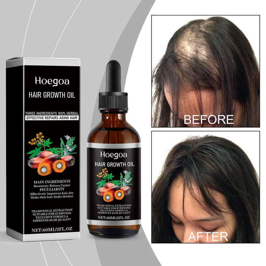 HOEGOA Palm Oil Hair Growth & Scalp Treatment Oil 60ml Scalp Treatment Oil QXL
