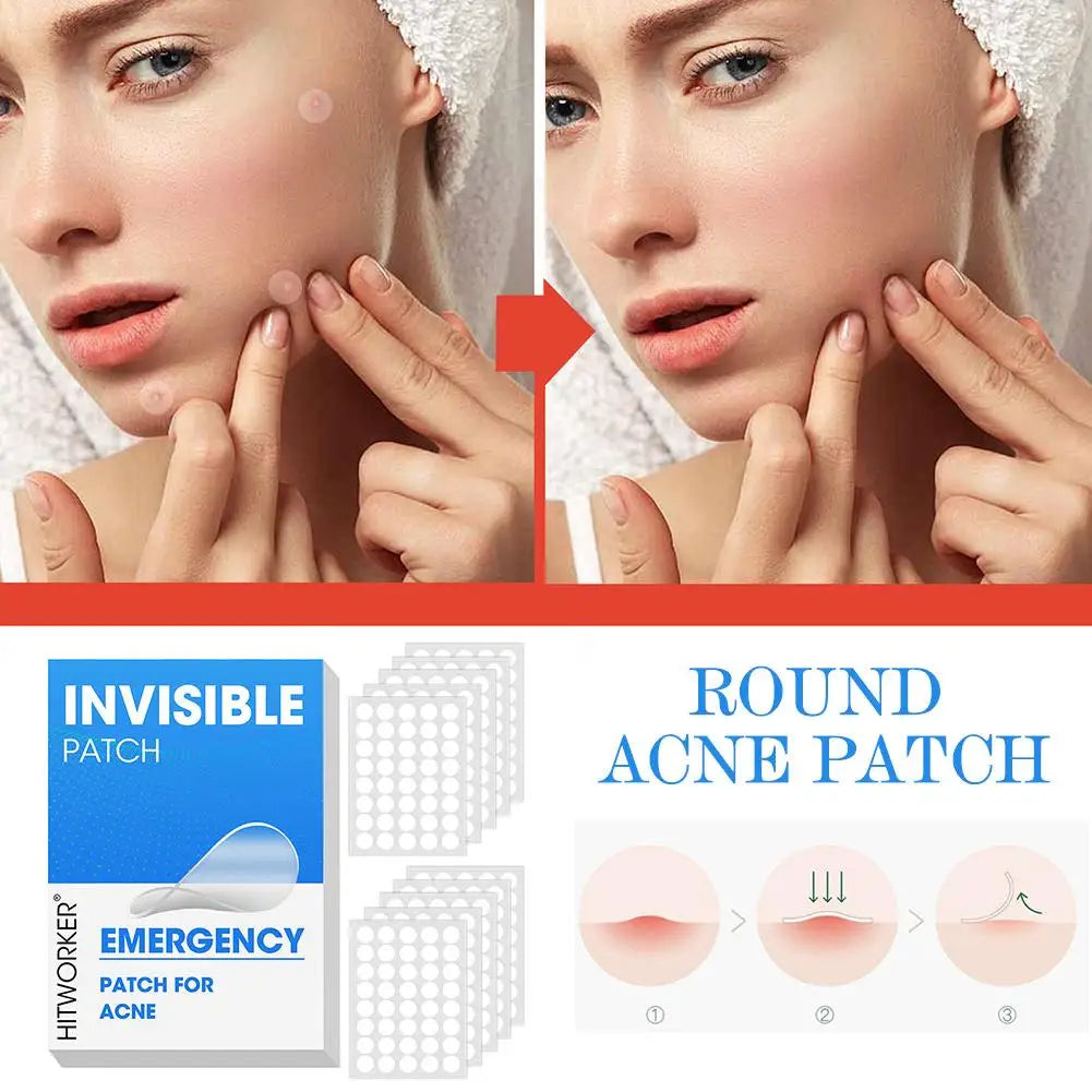 Hydrocolloid Acne Patches 400–1200 Pcs | Salicylic & Tea Tree Acne Patches QXL