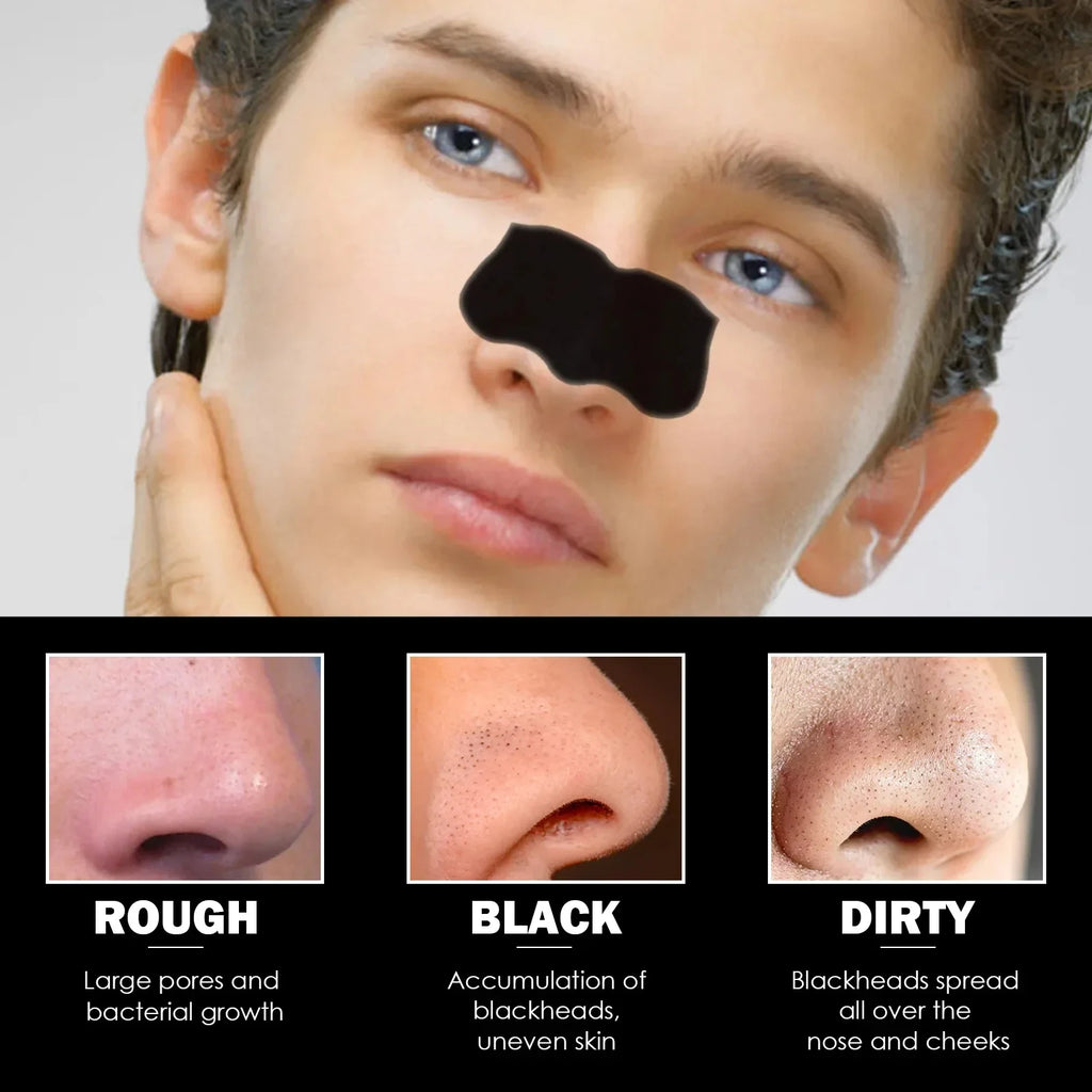 Nose Blackhead Remover Peel-Off Strips | Bamboo Charcoal 10pk Nose Peel-Off Strips QXL