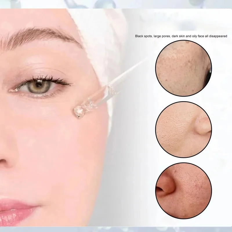 Pore-Minimizing Serum | Oil Control & Brightening Face Gel Face Serum QXL