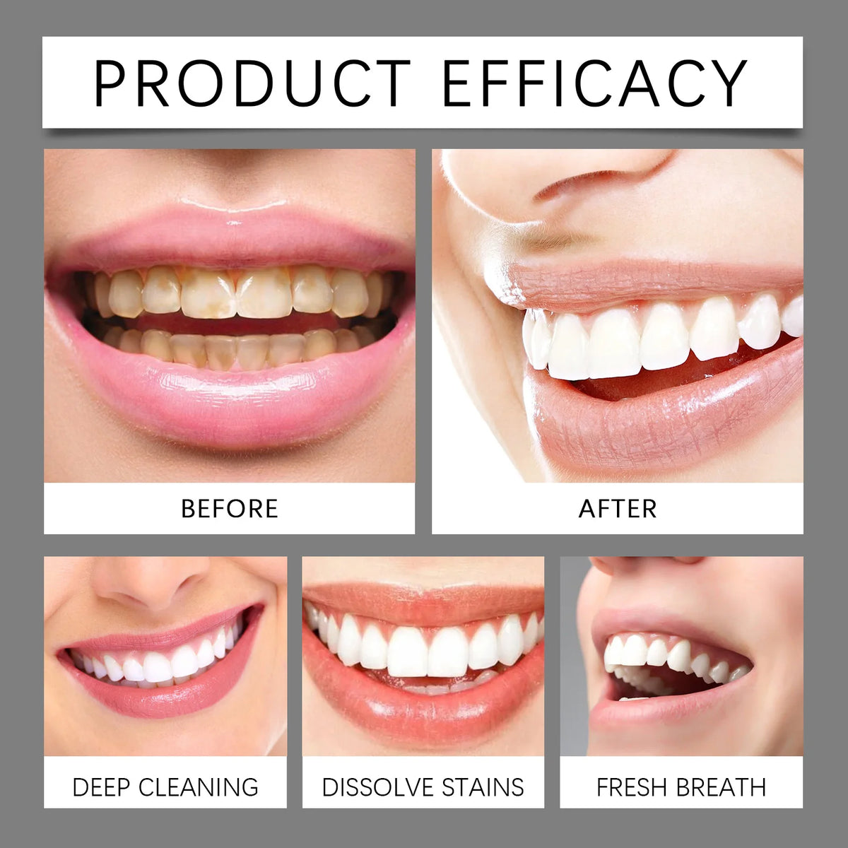 Oralhoe Hydroxyapatite Whitening Toothpaste | Enamel Repair Whitening Toothpaste QXL