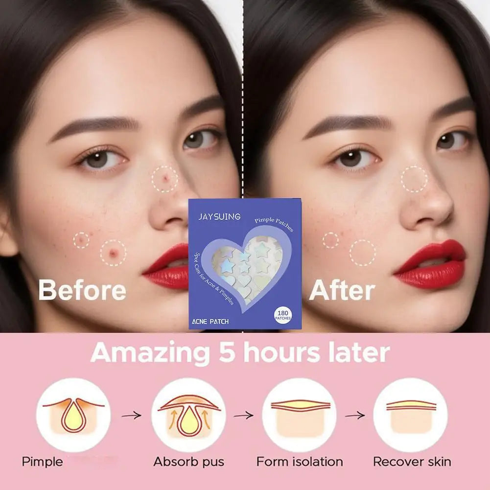 180-Pack Colorful Pimple Patches | Star & Heart Spot Stickers Pimple Patches QXL