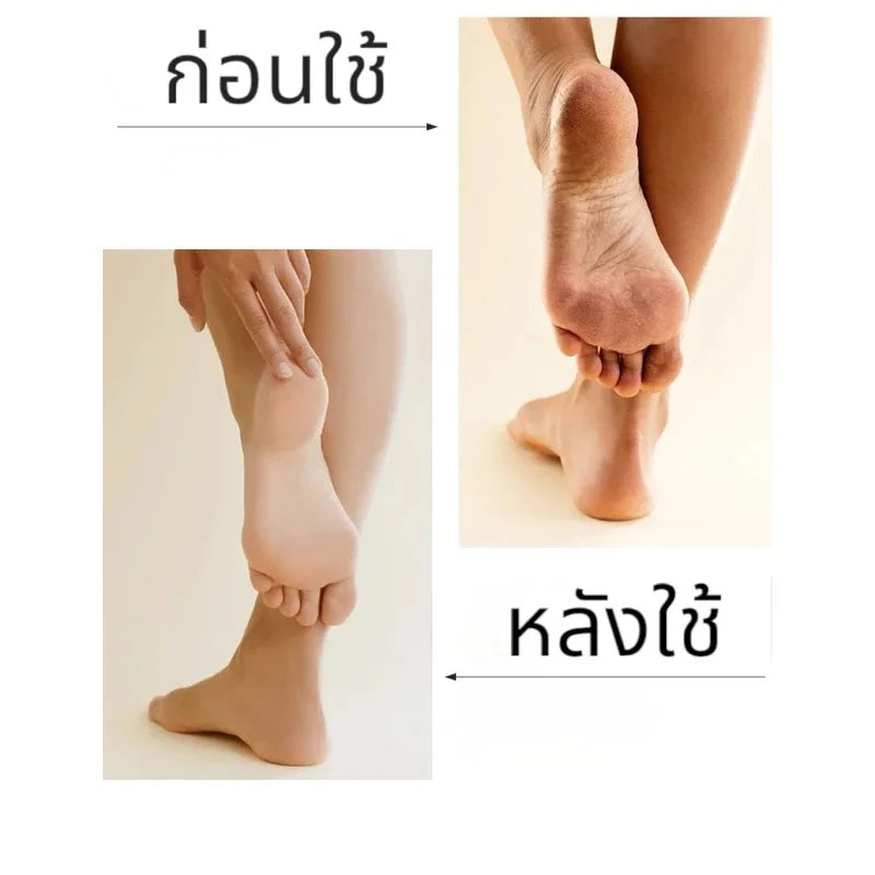 Natural Pumice Stone Foot Scrubber | Callus & Dead Skin Remover Pumice Stone Scrubber QXL