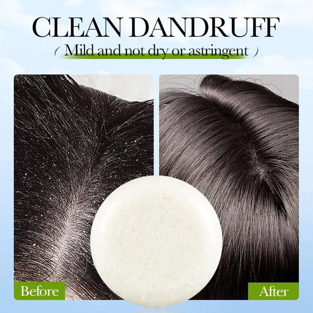 Rosemary Solid Shampoo Bar | Deep Cleanse & Strengthen Hair Solid Shampoo Bar QXL