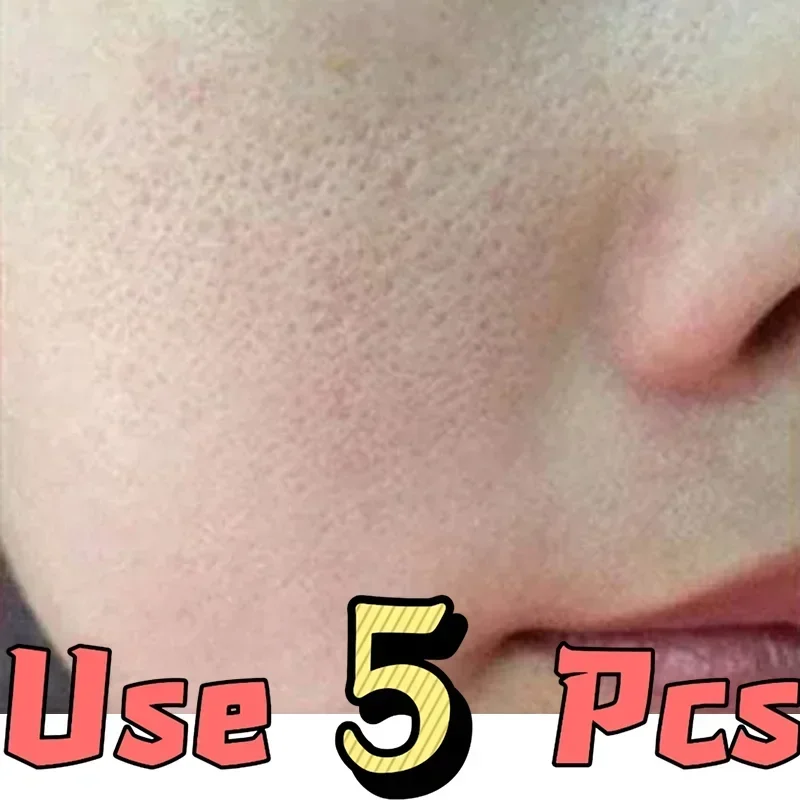 Pore-Minimizing Serum | Oil Control & Brightening Face Gel Face Serum QXL