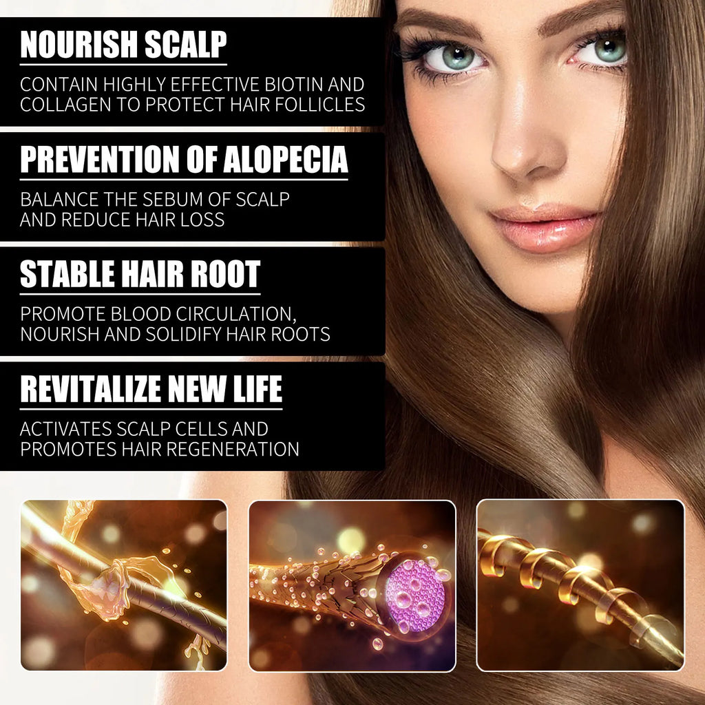 HOEGOA Biotin Collagen Scalp Serum | Rosemary Hair Oil 30ml Scalp Hair Serum QXL