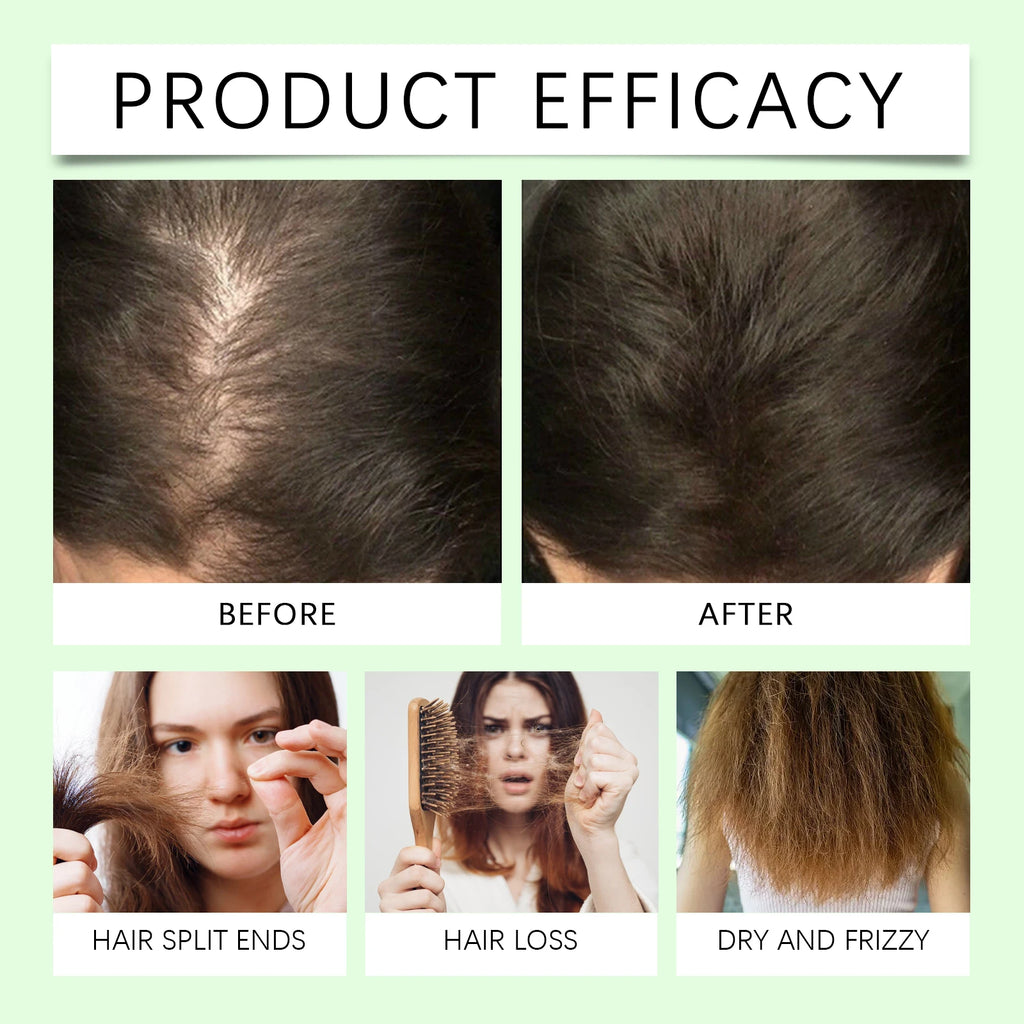 HOEGOA Rosemary Keratin Shampoo – Oil Control & Scalp Care Rosemary Shampoo QXL