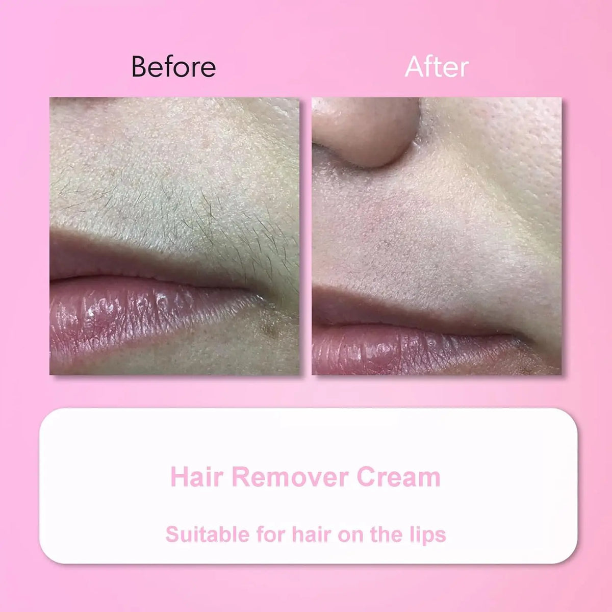 Women's Facial Hair Removal Cream Kit – Lip, Chin & Sideburns Depilatory Cream Kit QXL