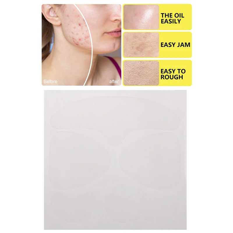 Large Full-Face Hydrocolloid Pimple Patches – 5 Pack Hydrocolloid Pimple Patch QXL