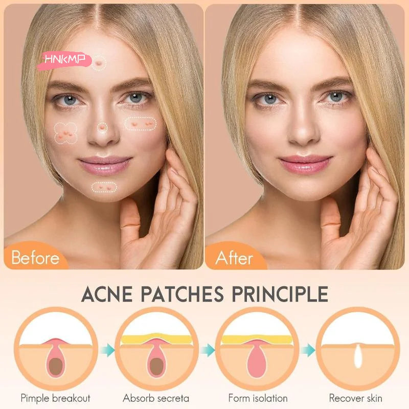 128-Pack Hydrocolloid Acne Patches | Invisible Salicylic Dots Acne Patch Set QXL