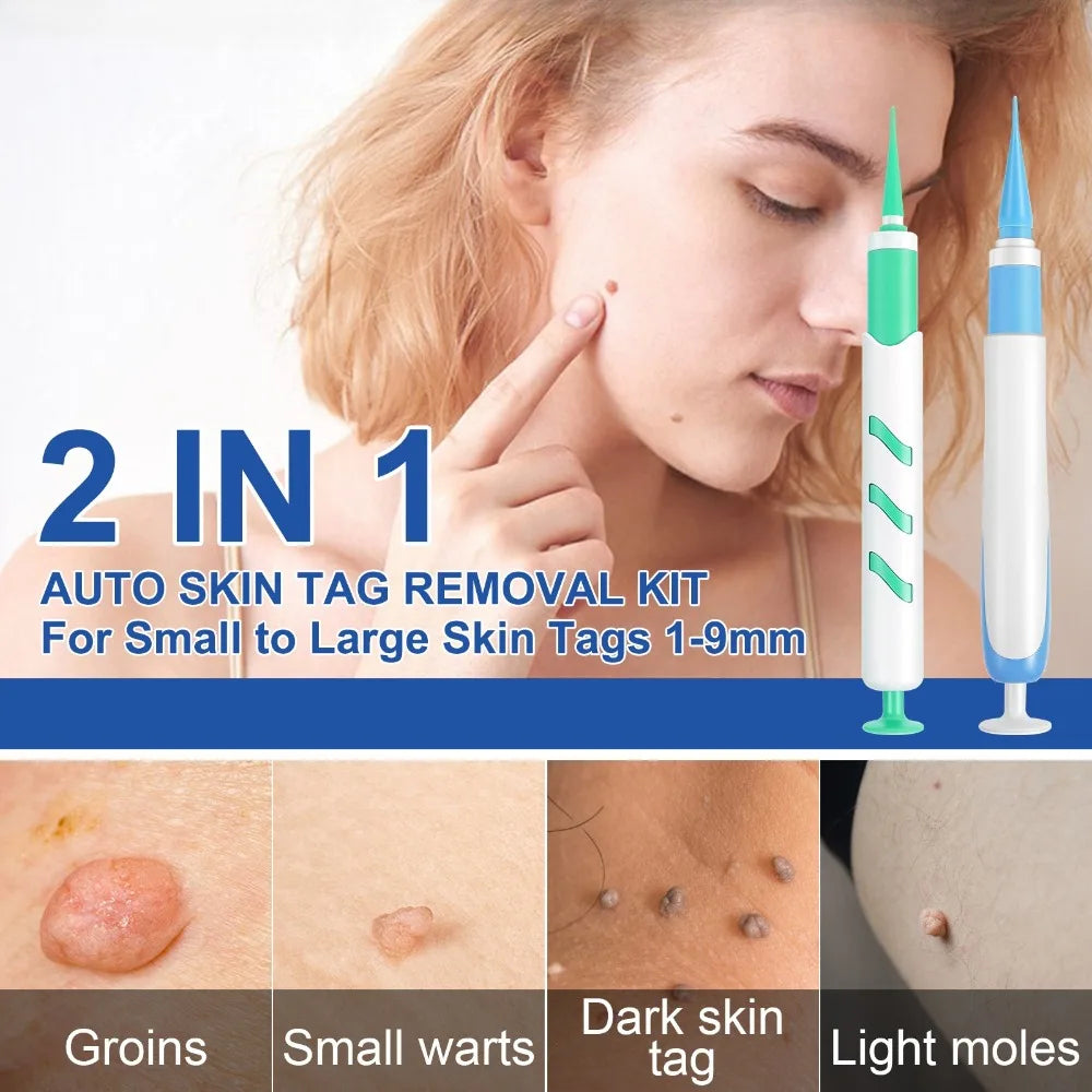 2-in-1 Skin Tag Remover Kit | 60 Bands, 1–9mm Skin Tag Remover QXL