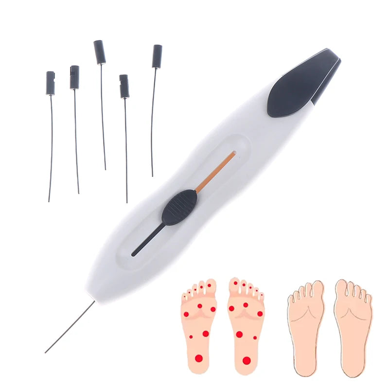 10g Nylon Monofilament Sensory Tester Pen | Foot & Skin Sensory Tester Pen QXL Default Title