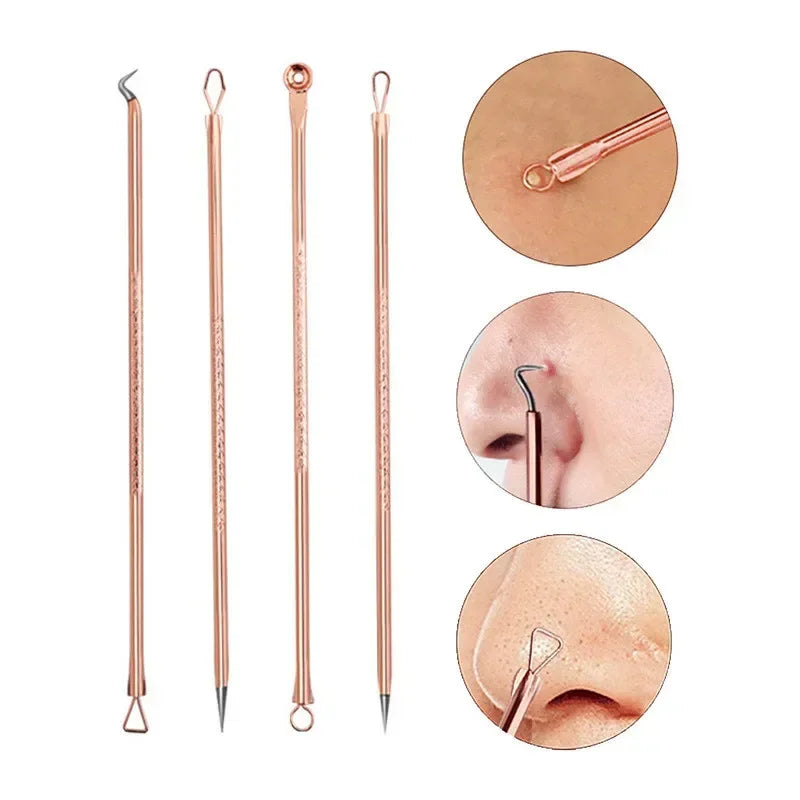 4-Piece Stainless Steel Blackhead & Blemish Removal Tool Set Blemish Extraction Kit QXL