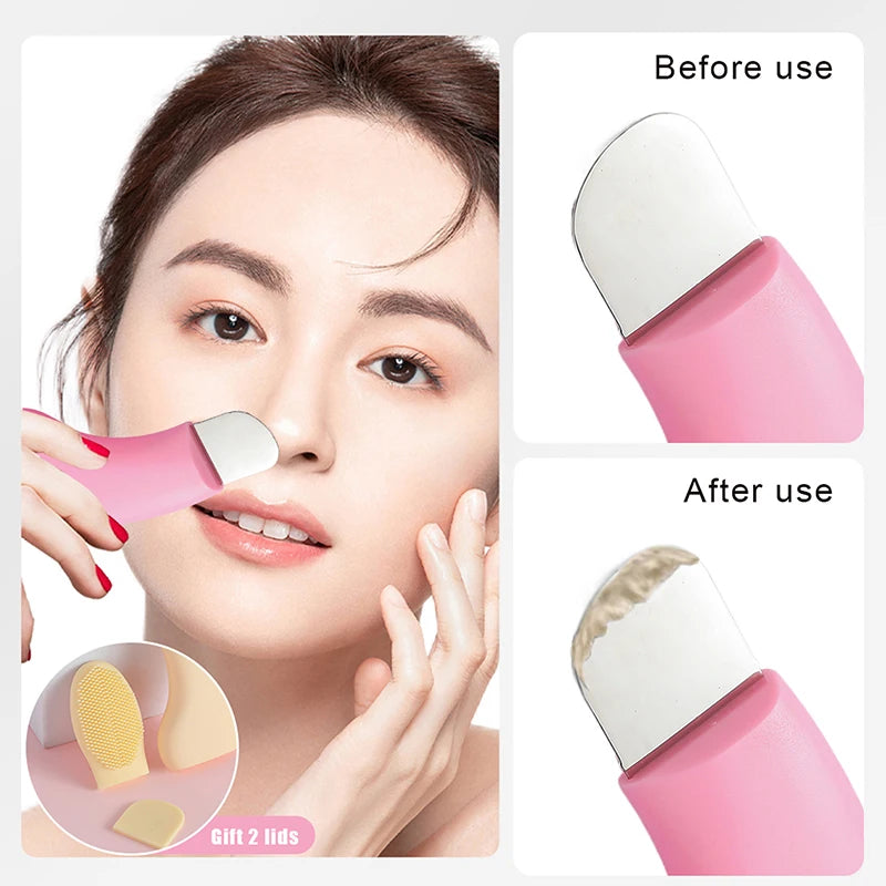 Silicone Blackhead Removal & Facial Cleansing Scraper Tool Facial Cleansing Tool QXL