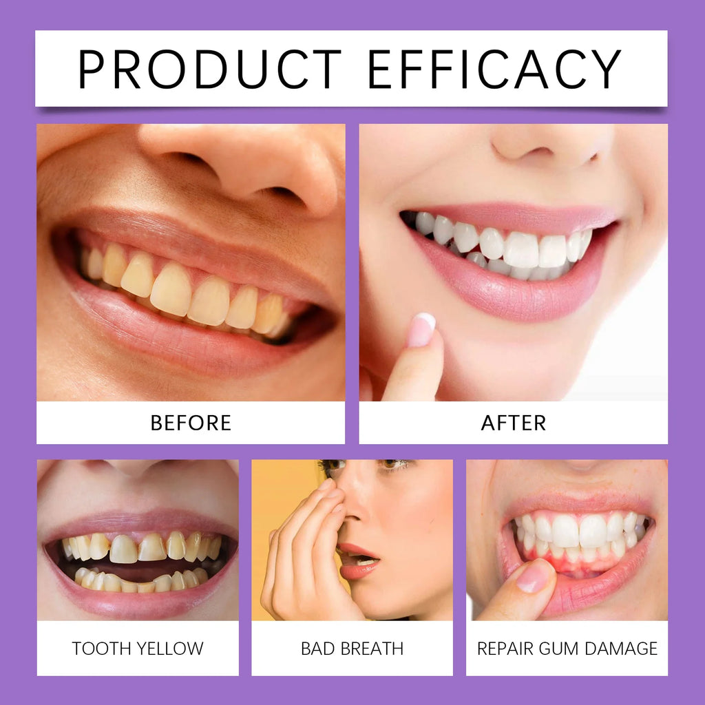 Oralhoe Hydroxyapatite Purple Toothpaste | Whitening Mint 114g Whitening Toothpaste QXL