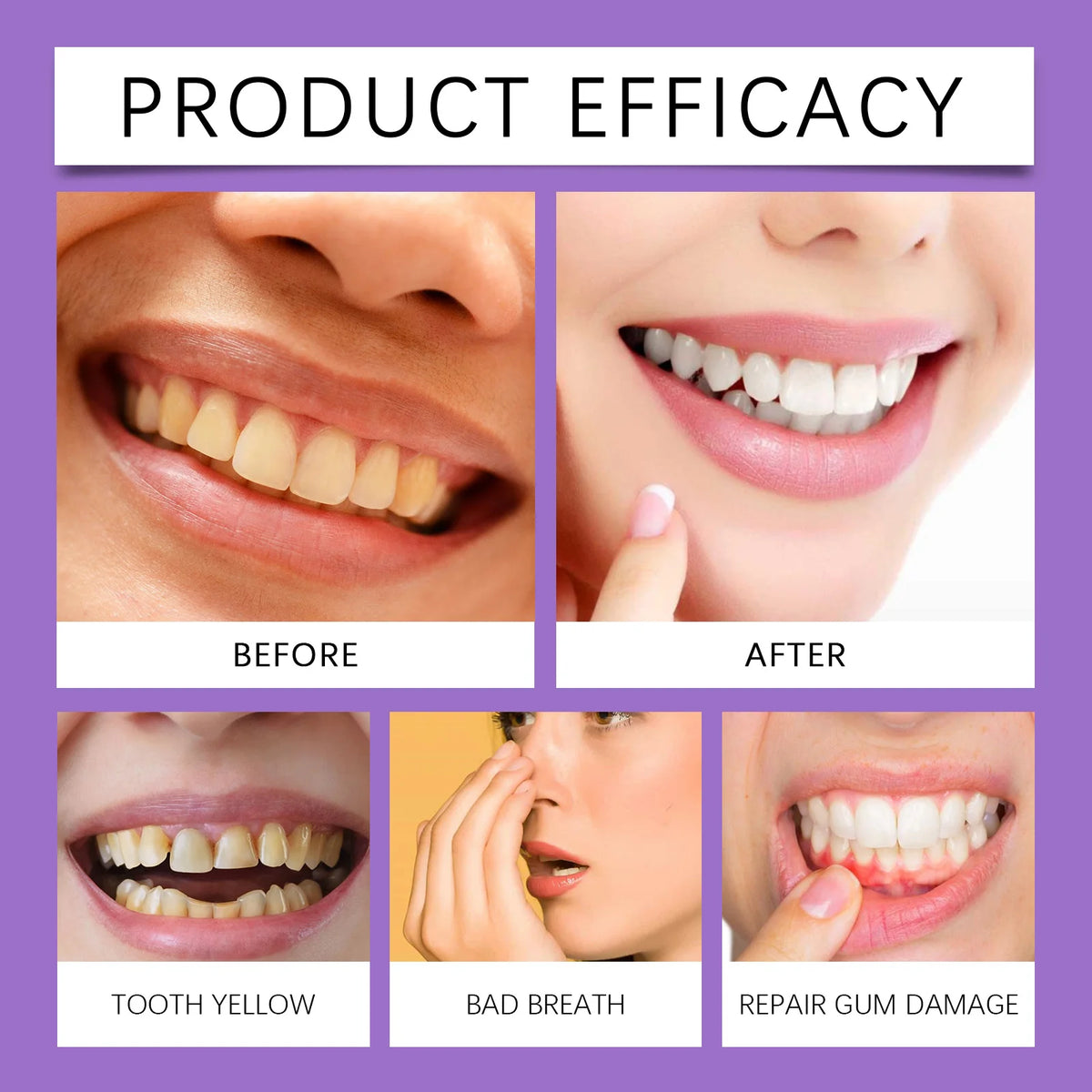 Oralhoe Hydroxyapatite Purple Toothpaste | Whitening Mint 114g Whitening Toothpaste QXL