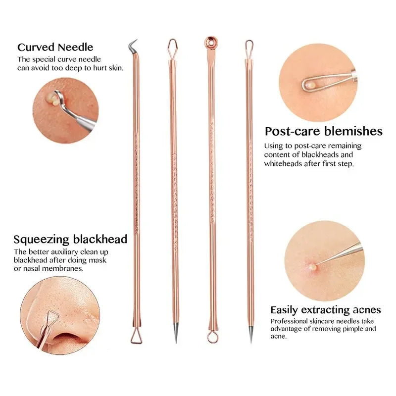 4-Piece Stainless Steel Blackhead & Blemish Removal Tool Set Blemish Extraction Kit QXL