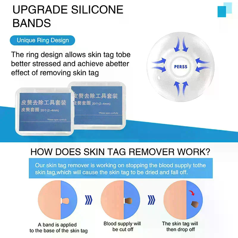 20-Pack Skin Tag Removal Rubber Bands Kit | Face & Body Skin Tag Remover QXL
