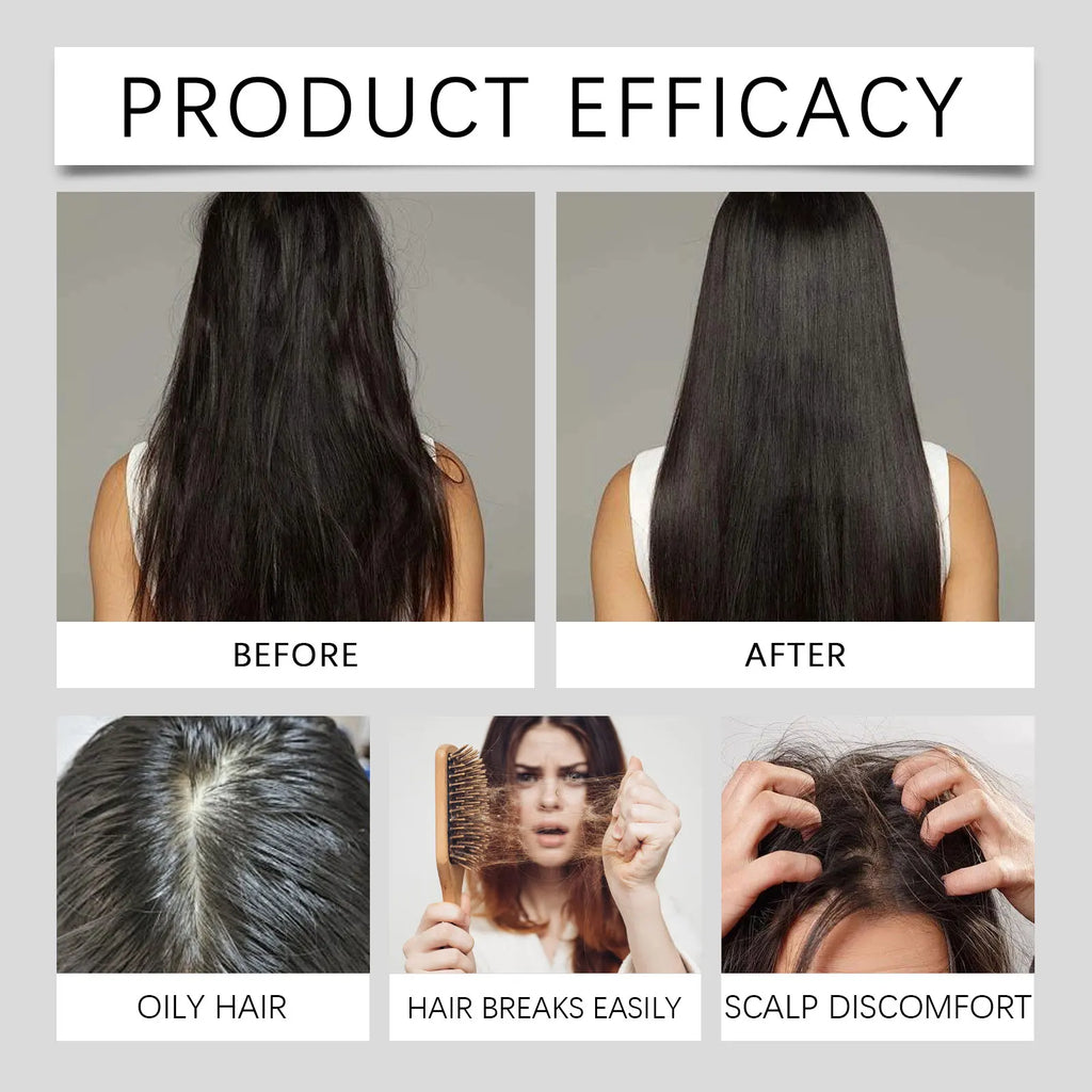 HOEGOA Rosemary & Mint Shampoo & Conditioner Set – All Hair Shampoo & Conditioner Set QXL