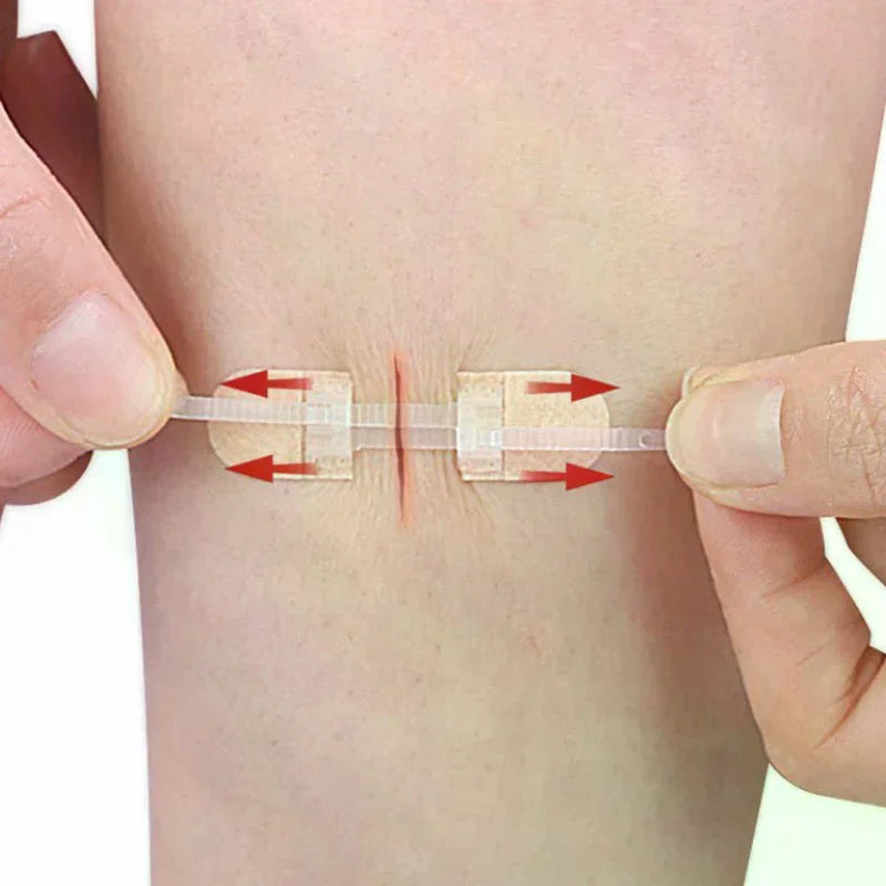 Zipper Wound Closure Patch | Elastic Breathable Bandage Strip Wound Closure Patch QXL