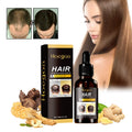 HOEGOA Ginger Hair Growth Serum Oil – Nourishing Scalp Essence Hair Growth Serum QXL 1pcs