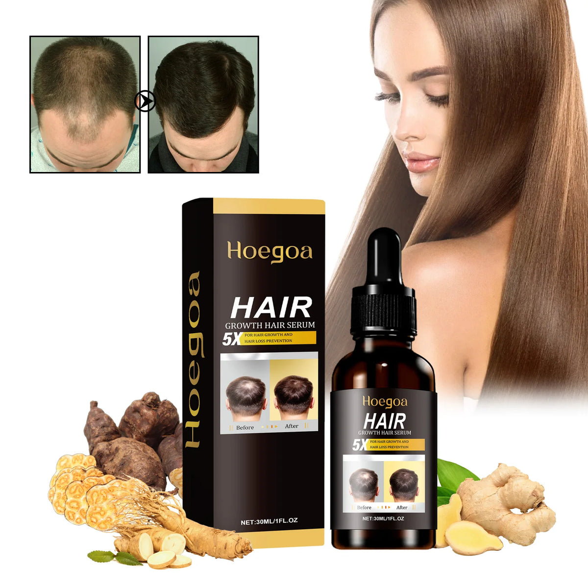 HOEGOA Ginger Hair Growth Serum Oil – Nourishing Scalp Essence Hair Growth Serum QXL 1pcs