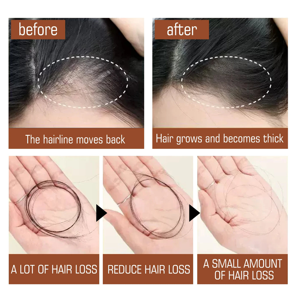 Eelhoe Batana Oil Hair Mask – Nourish, Strengthen & Shine Hair Conditioning Mask QXL