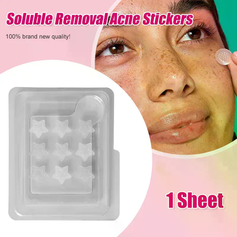 Salicylic Acid Microneedle Acne Patches | Blemish Treatment Acne Patch QXL