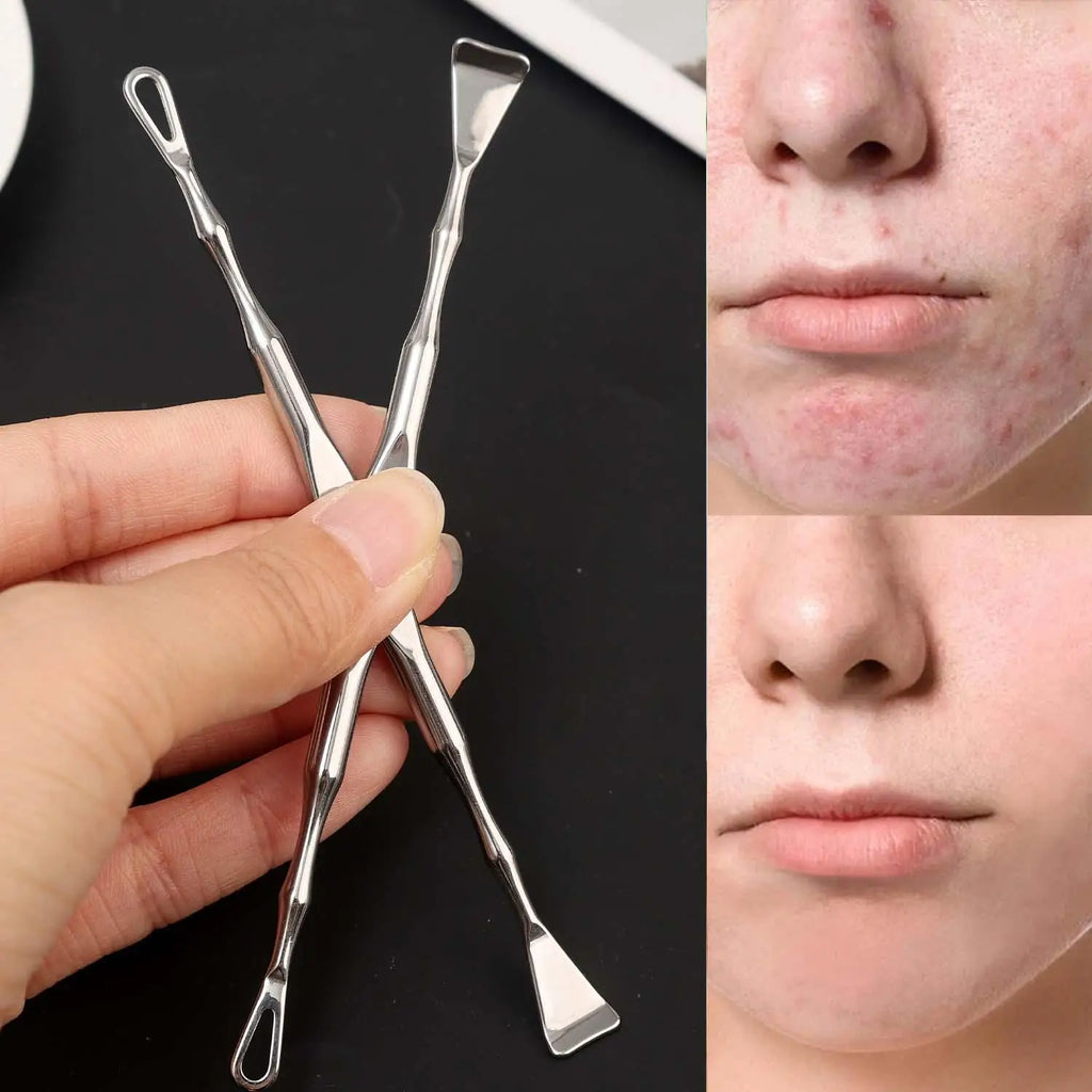 Double-Ended Stainless Steel Blackhead Extractor Tool Blackhead Extractor Tool QXL