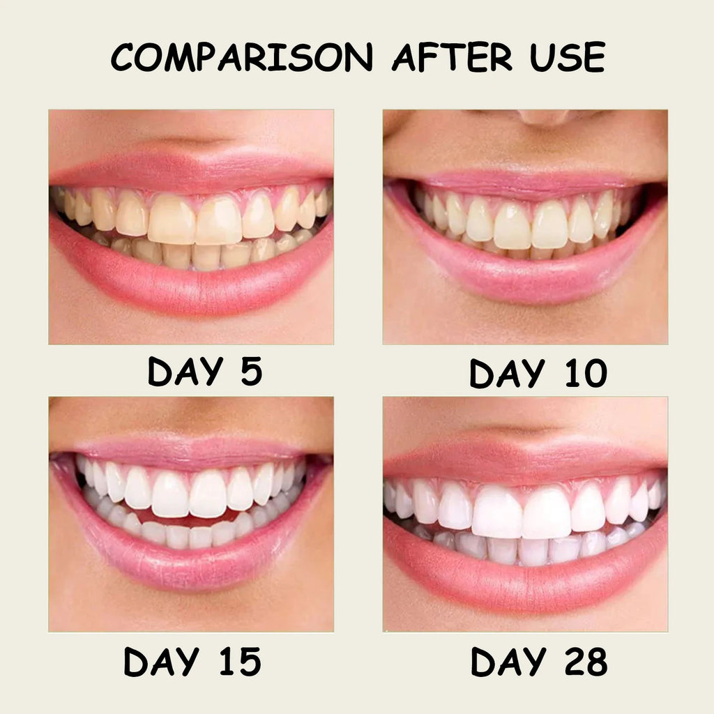 Eelhoe Xylitol Whitening Toothpaste | Tartar & Fresh Breath Whitening Toothpaste QXL