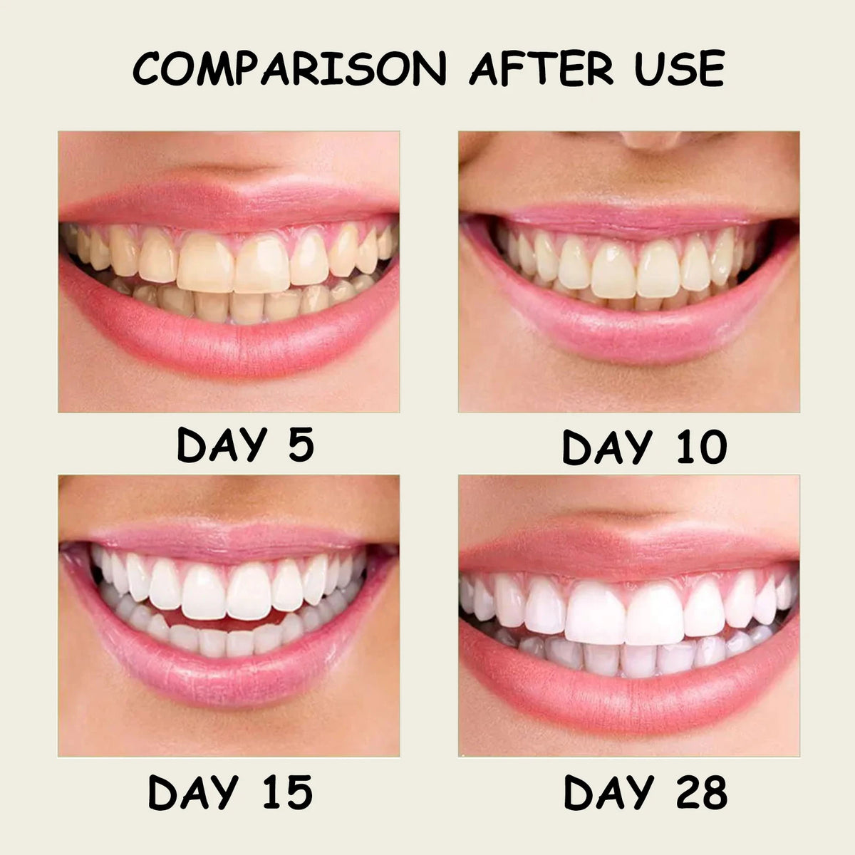 Eelhoe Xylitol Whitening Toothpaste | Tartar & Fresh Breath Whitening Toothpaste QXL