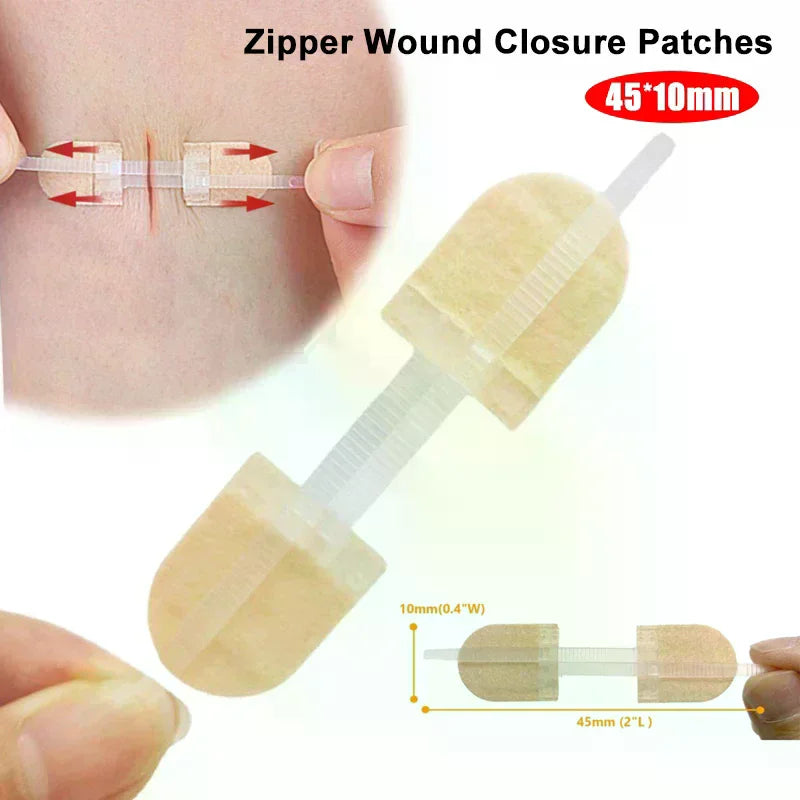 Zipper Wound Closure Patches | Breathable Elastic Bandage Wound Closure Patch QXL