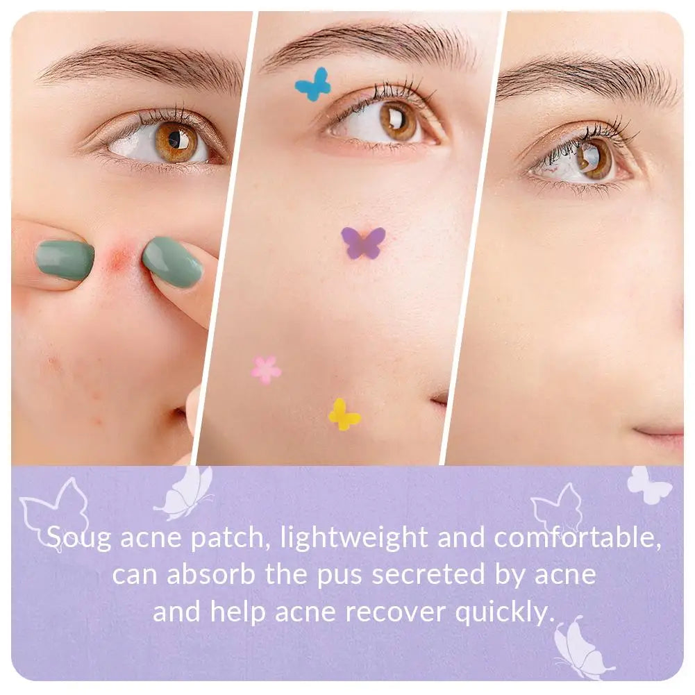 120-Pack Butterfly Blemish Spot Patches | Ultra-Thin 0.1mm Blemish Spot Patch QXL