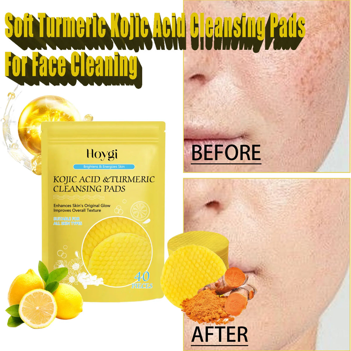 Turmeric Kojic Acid Cleansing & Exfoliating Pads | Eelhoe Facial Cleansing Pads QXL