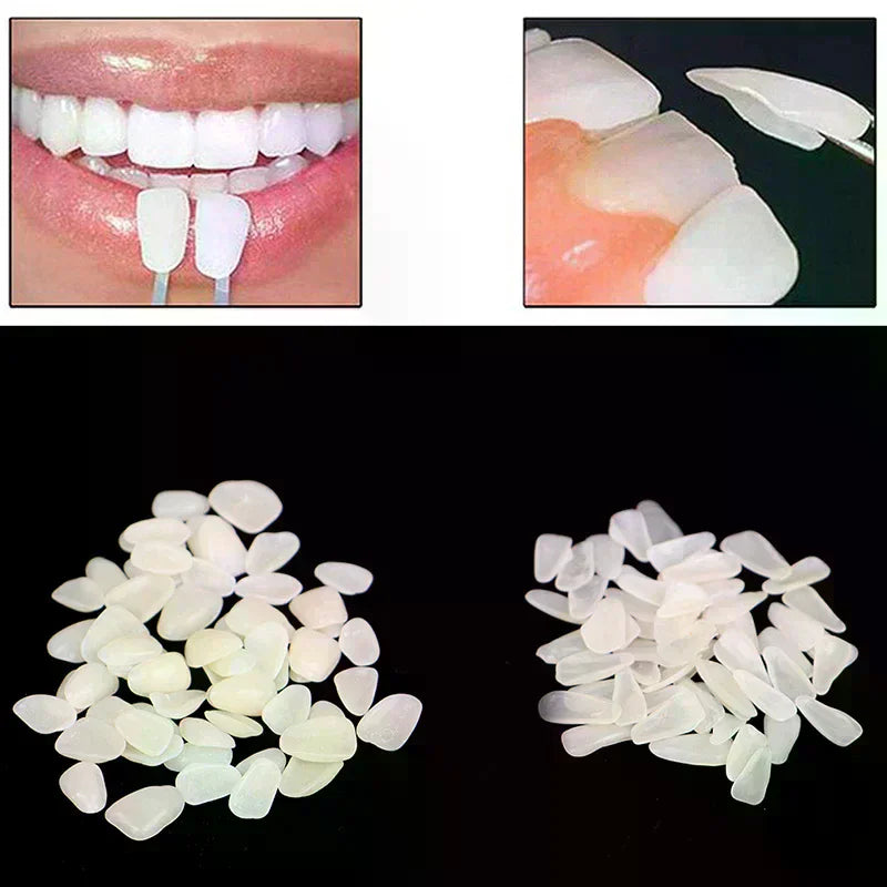 60-Pack Ultra-Thin Resin Temporary Dental Veneers | No Glue Temporary Dental Veneers QXL