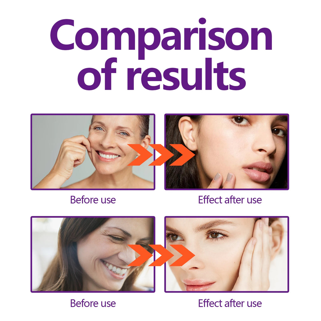 HOEGOA Hyaluronic Acid Face Lift Cream – Firm & Brighten 30ml Face Lift Cream QXL
