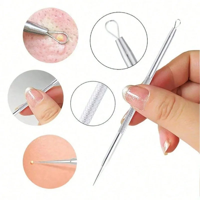 4-Piece Blackhead Comedone Extractor Kit – Stainless Steel Tools Comedone Extractor Kit QXL