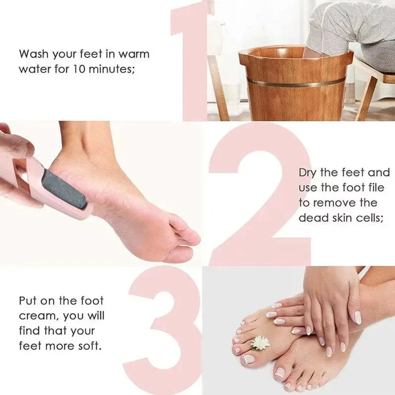 Electric Foot Callus Remover – Rechargeable Pedicure File Electric Foot File QXL